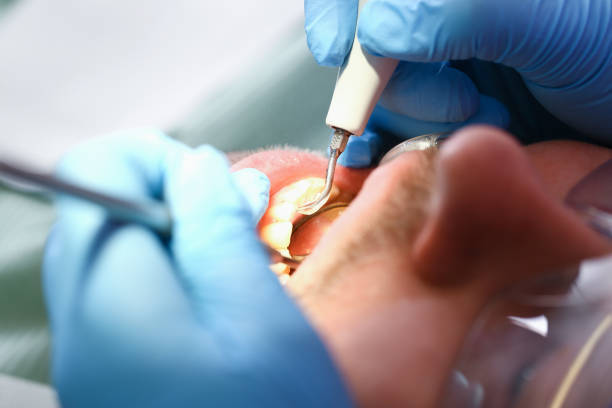 Best Walk-In Emergency Dentist in Springfield, FL