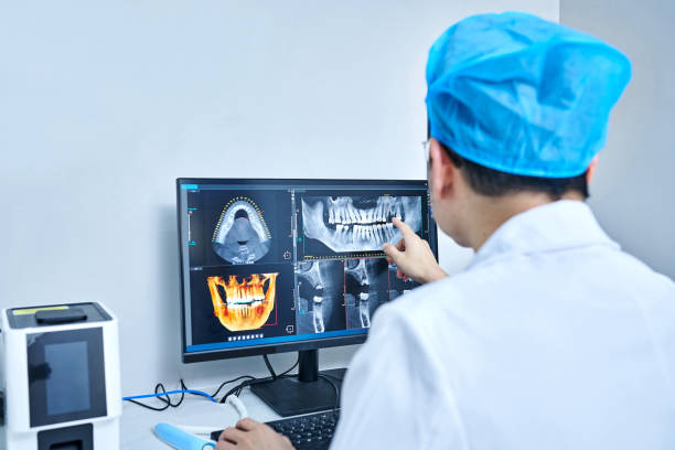 Best Emergency Tooth Extraction in Springfield, FL